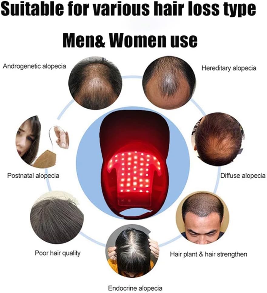 قبعة نمو الشعر باضاءة LED من ار ار-واي ار ال، قبعة علاج بالضوء الاحمر لنمو الشعر، قبعة بالاشعة تحت الحمراء لمكافحة تساقط الشعر مع 48 مصباح LED لفروة الرأس